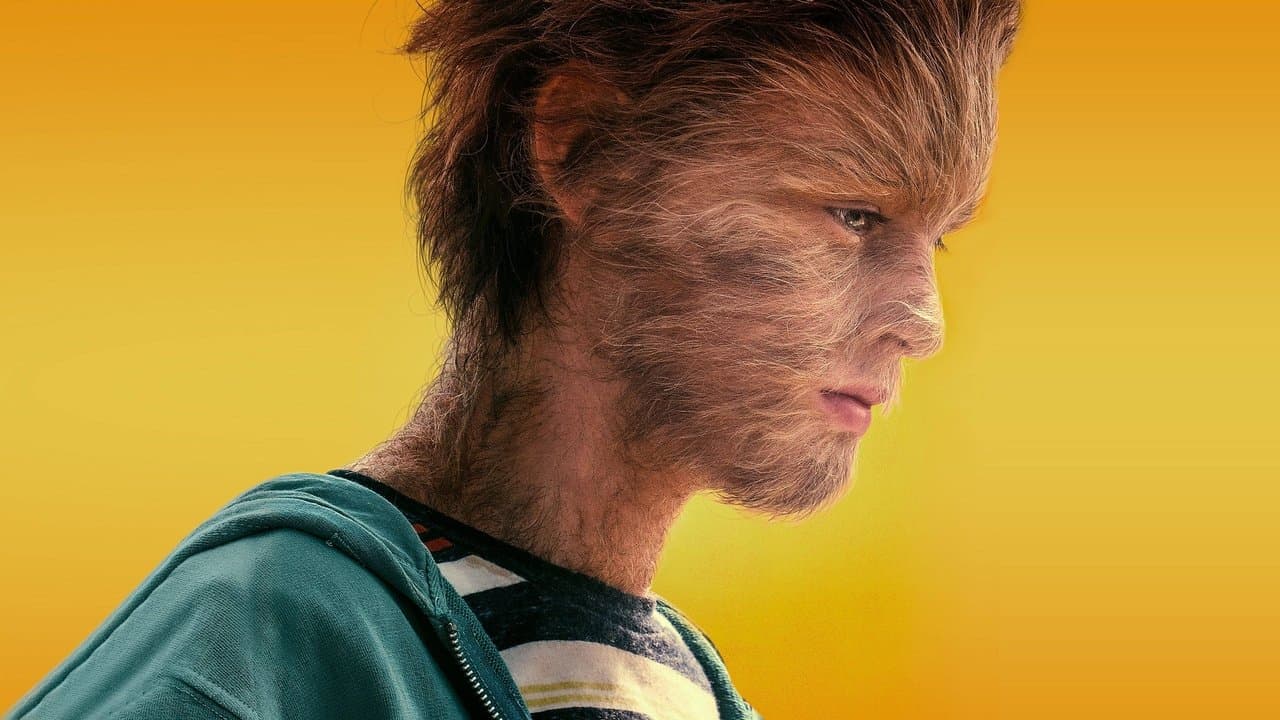 Kurt Çocuğun Gerçek Hikayesi